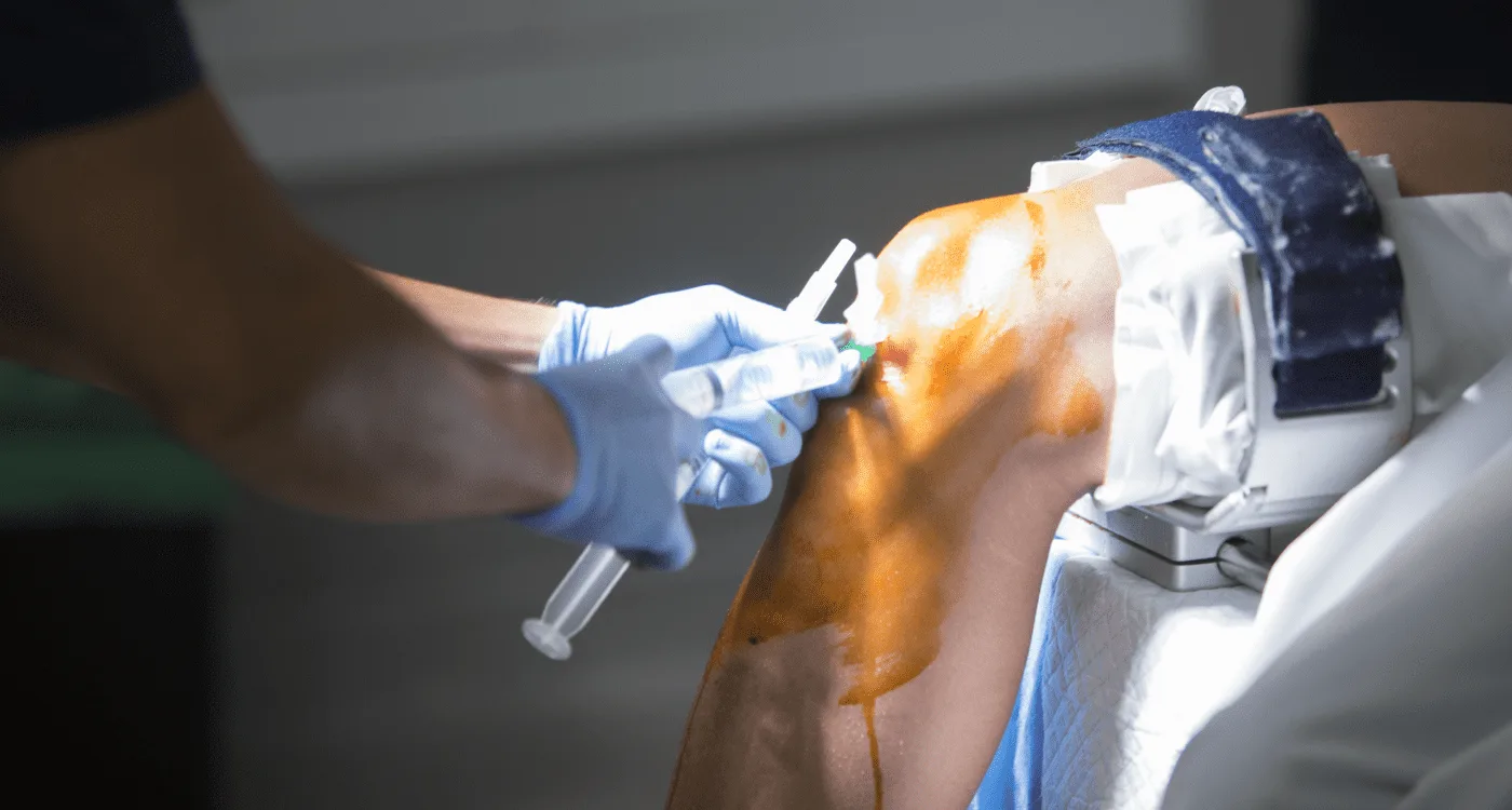 ¿Qué es la bursitis y cómo tratarla con especialistas en Metepec?