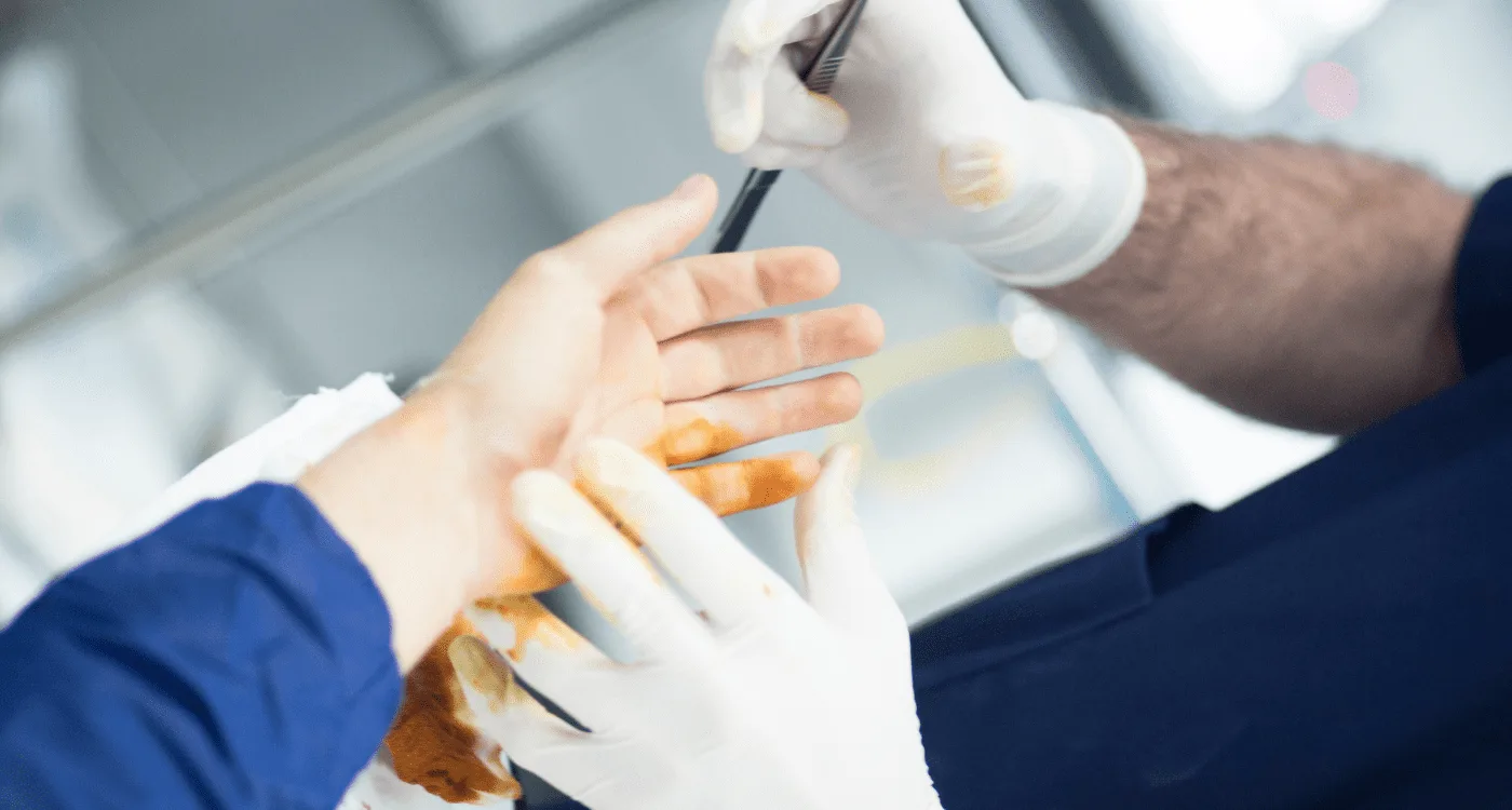 ¿Qué especialista trata la bursitis?