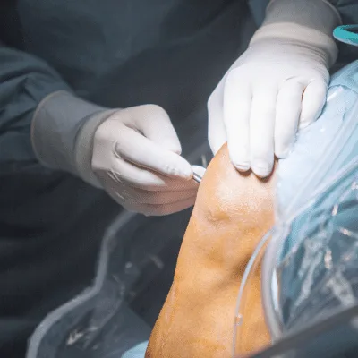 ¿Qué especialista trata el dolor de rodilla?