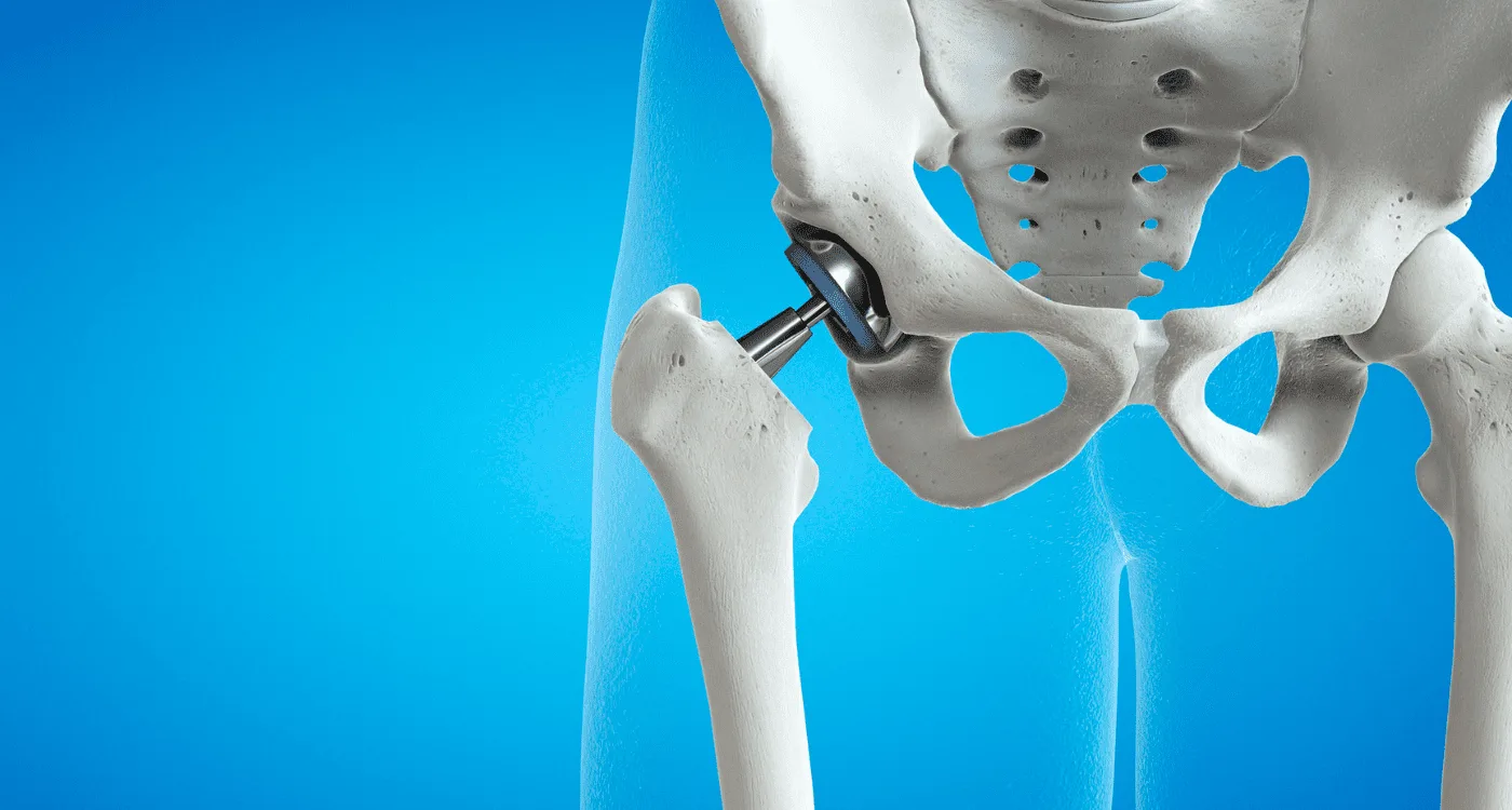 Atención especializada para la lesión de ligamentos en Metepec