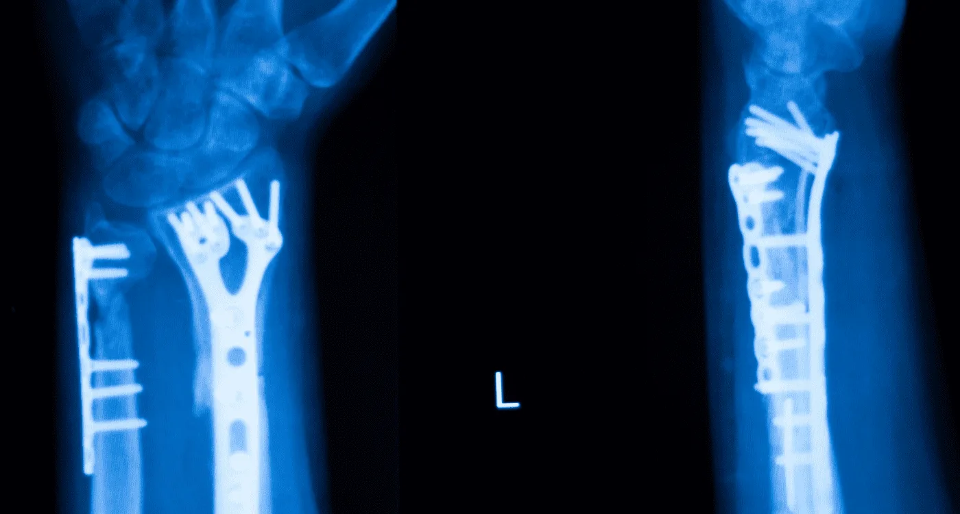 ¿Qué especialista trata la lesión de ligamentos?
